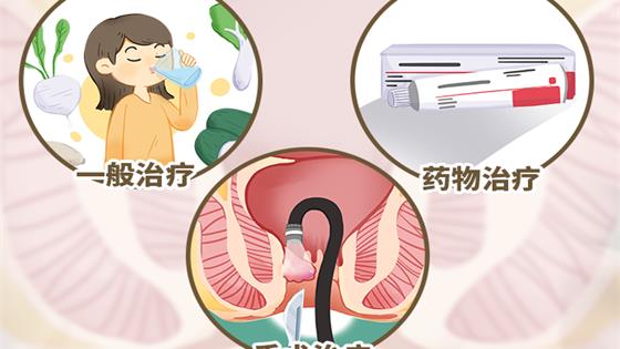 痔疮如何治疗
