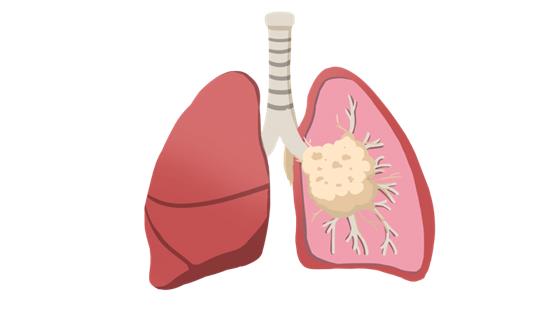 吃猪血能清肺排毒？吃猪血对身体是好还是坏？