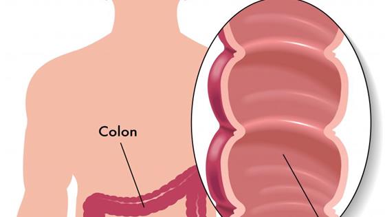 上厕所时出现4个症状，就是肠子长息肉了，有人还后知后觉