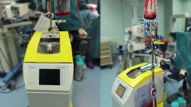 让血“失而复得”——手术中的自体血回输是怎么一回事？