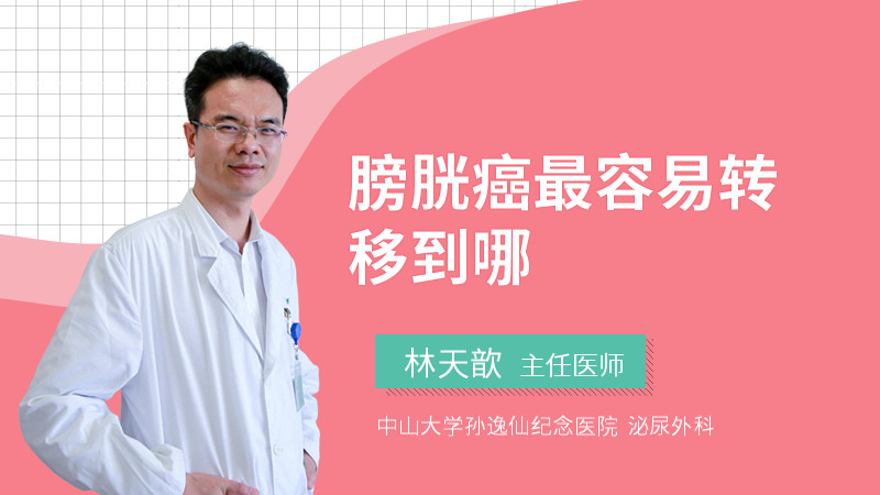 膀胱癌最容易转移到哪