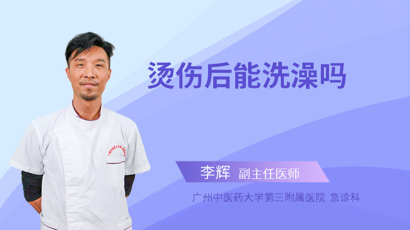 烫伤后能洗澡吗