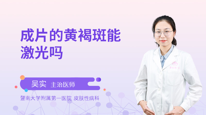 成片的黄褐斑能激光吗