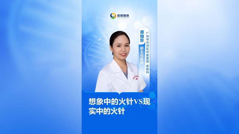 想象中的火针VS现实中的火针