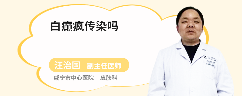 白癫疯传染吗