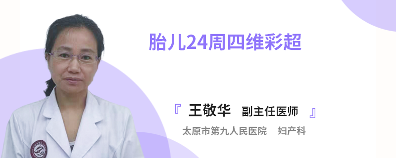 胎儿24周四维彩超