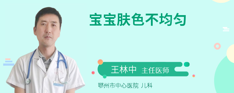 宝宝肤色不均匀