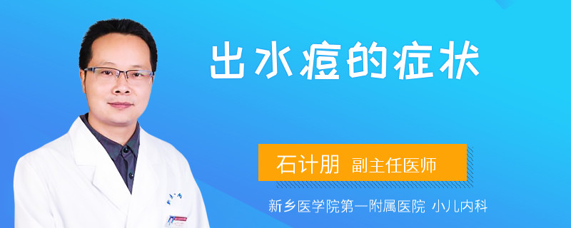 出水痘的症状