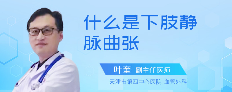 什么是下肢静脉曲张