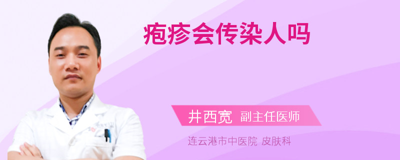 疱疹会传染人吗