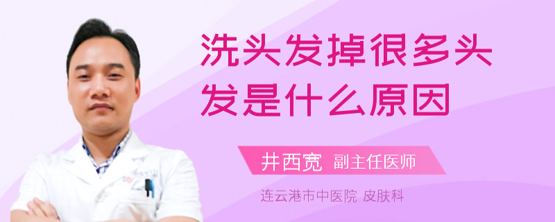 洗头发掉很多头发是什么原因