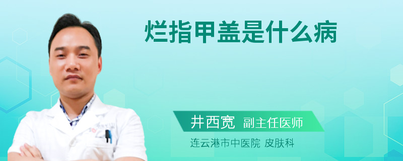 烂指甲盖是什么病