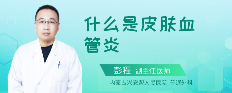 什么是皮肤血管炎