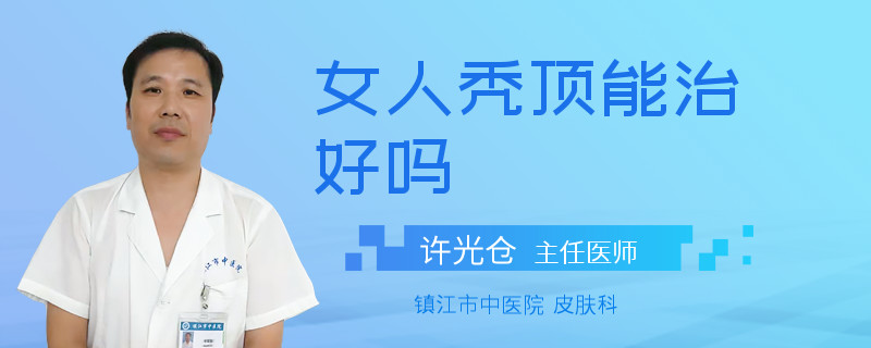 女人秃顶能治好吗