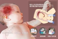 新生儿颅内出血