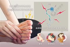 多发性末梢神经炎