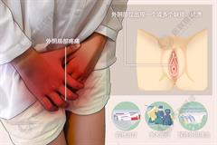 外阴溃疡