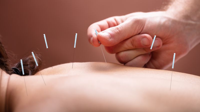 肩周炎针灸有副作用吗，需要多少钱？