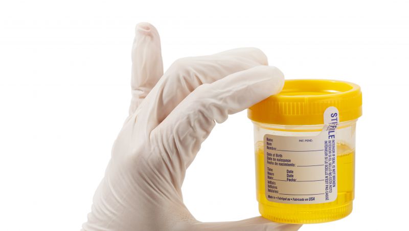 小孩小便有骚味是怎么回事