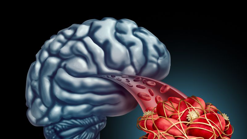 如何吃赶走血栓？5种食物每日适量吃，清理血管，赶走血栓