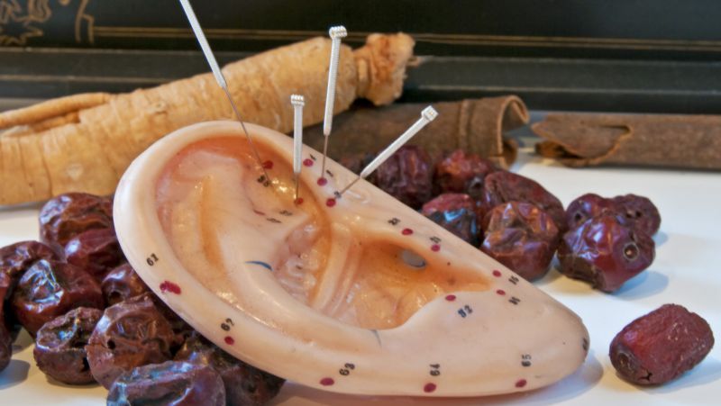 贴耳豆治近视有效吗