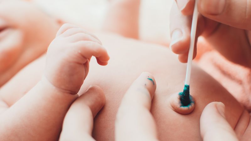 新生儿肚脐渗血严重吗